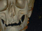 Haydns Kopf